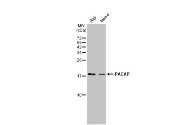 Anti-MZB1?antibody used in Western Blot (WB). GTX106794