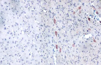 Anti-MZB1?antibody used in IHC (Paraffin sections) (IHC-P). GTX106794