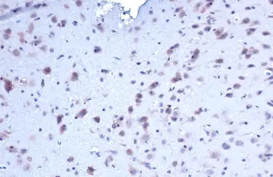Anti-MZB1?antibody used in IHC (Paraffin sections) (IHC-P). GTX106794