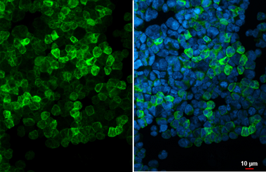 Anti-MZB1?antibody used in Immunocytochemistry/ Immunofluorescence (ICC/IF). GTX106794