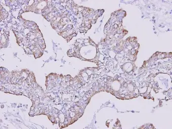 Anti-FOXRED1 antibody [C1C3] used in IHC (Paraffin sections) (IHC-P). GTX106823
