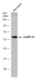 Anti-hnRNP H2 antibody used in Western Blot (WB). GTX106825
