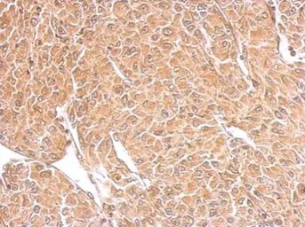 Anti-TSPAN3 antibody used in IHC (Paraffin sections) (IHC-P). GTX106868