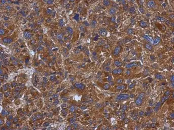 Anti-TXNDC5 antibody used in IHC (Paraffin sections) (IHC-P). GTX106914