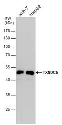 Anti-TXNDC5 antibody used in Western Blot (WB). GTX106914