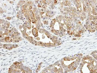 Anti-ZER1 antibody [C2C3], C-term used in IHC (Paraffin sections) (IHC-P). GTX106983