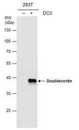 Anti-Doublecortin antibody [N3C3] used in Western Blot (WB). GTX107133