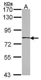 Anti-C6orf97 antibody used in Western Blot (WB). GTX107144