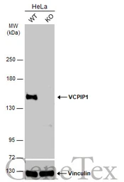 Anti-VCPIP1 antibody [C2C3], C-term used in Western Blot (WB). GTX107169