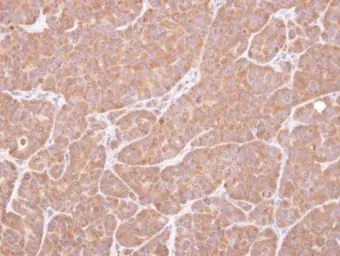 Anti-VCPIP1 antibody [C2C3], C-term used in IHC (Paraffin sections) (IHC-P). GTX107169