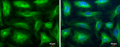 Anti-beta Tubulin antibody used in Immunocytochemistry/ Immunofluorescence (ICC/IF). GTX107175