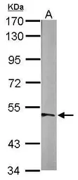 Anti-beta Tubulin antibody used in Western Blot (WB). GTX107175