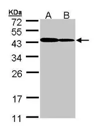 Anti-ART5 antibody [N1C3] used in Western Blot (WB). GTX107199
