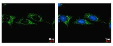 Anti-ALDH1B1 antibody used in Immunocytochemistry/ Immunofluorescence (ICC/IF). GTX107279