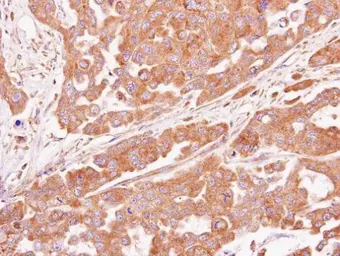 Anti-ASB4 antibody [N1C3] used in IHC (Paraffin sections) (IHC-P). GTX107345