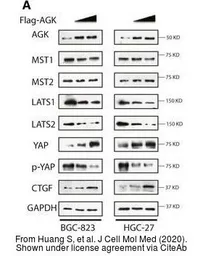 Anti-Acylglycerol kinase antibody used in Western Blot (WB). GTX107413