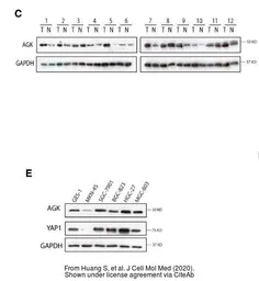Anti-Acylglycerol kinase antibody used in Western Blot (WB). GTX107413