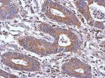 Anti-PAPSS1 antibody [N1C1] used in IHC (Paraffin sections) (IHC-P). GTX107427