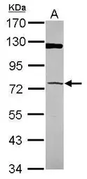 Anti-PAPSS1 antibody [N1C1] used in Western Blot (WB). GTX107427