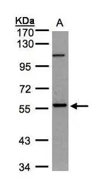 Anti-NEK3 antibody [N1C1] used in Western Blot (WB). GTX107436