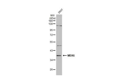 Anti-MEK6 antibody [N1C3] used in Western Blot (WB). GTX107445