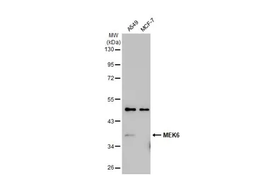 Anti-MEK6 antibody [N1C3] used in Western Blot (WB). GTX107445