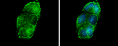 Anti-Glycerol kinase antibody [N1N3-2] used in Immunocytochemistry/ Immunofluorescence (ICC/IF). GTX107474