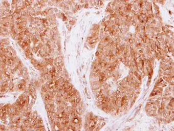Anti-CaMKI gamma antibody used in IHC (Paraffin sections) (IHC-P). GTX107499