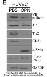 Anti-TIE2 antibody used in Western Blot (WB). GTX107505
