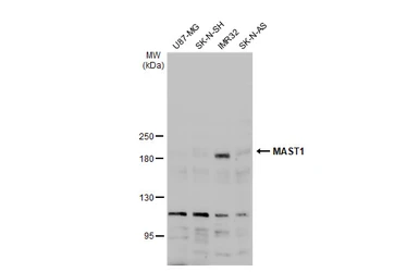 Anti-MAST1 antibody [N2N3] used in Western Blot (WB). GTX107508