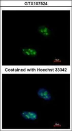 Anti-EXOSC10 antibody used in Immunocytochemistry/ Immunofluorescence (ICC/IF). GTX107524
