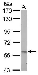 Anti-Pyruvate Kinase (liver/RBC) antibody used in Western Blot (WB). GTX107546