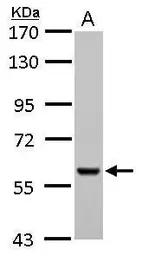 Anti-Pyruvate Kinase (liver/RBC) antibody used in Western Blot (WB). GTX107546