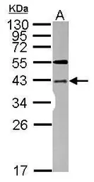 Anti-LYK5 antibody used in Western Blot (WB). GTX107557