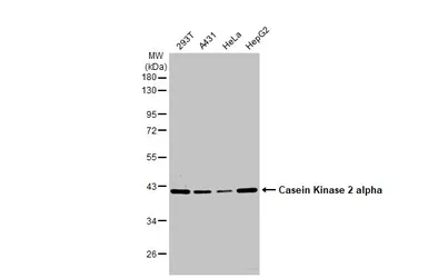 Anti-Casein Kinase 2 alpha antibody used in Western Blot (WB). GTX107576