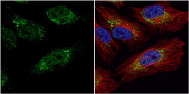 Anti-PGK1 antibody used in Immunocytochemistry/ Immunofluorescence (ICC/IF). GTX107614