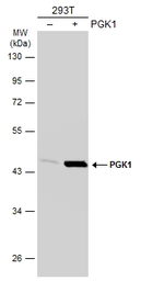 Anti-PGK1 antibody used in Western Blot (WB). GTX107614