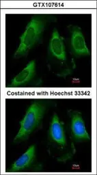Anti-PGK1 antibody used in Immunocytochemistry/ Immunofluorescence (ICC/IF). GTX107614