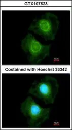Anti-COASY antibody used in Immunocytochemistry/ Immunofluorescence (ICC/IF). GTX107623