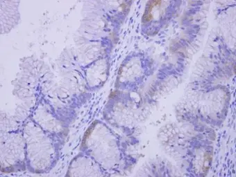 Anti-COASY antibody used in IHC (Paraffin sections) (IHC-P). GTX107623