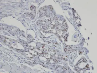 Anti-SART3 antibody [C3], C-term used in IHC (Paraffin sections) (IHC-P). GTX107684