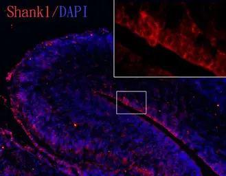 Anti-SHANK1 antibody [C3], C-term used in IHC (Frozen sections) (IHC-Fr). GTX107701