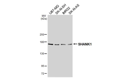 Anti-SHANK1 antibody [C3], C-term used in Western Blot (WB). GTX107701