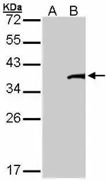 Anti-TFB2M antibody [C3], C-term used in Western Blot (WB). GTX107714