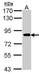 Anti-VPS16 antibody used in Western Blot (WB). GTX107716