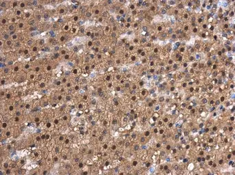 Anti-CDK9 antibody [N3C3] used in IHC (Paraffin sections) (IHC-P). GTX107758