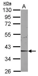 Anti-CDK9 antibody [N3C3] used in Western Blot (WB). GTX107758