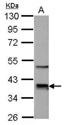 Anti-CDK9 antibody [N3C3] used in Western Blot (WB). GTX107758