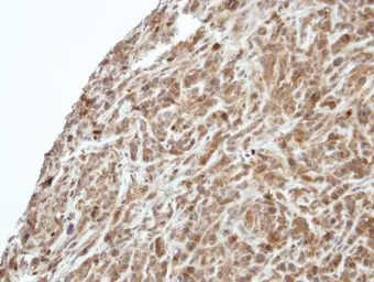 Anti-PI3 kinase p55 gamma antibody used in IHC (Paraffin sections) (IHC-P). GTX107779