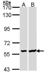 Anti-Lck antibody [N3C3] used in Western Blot (WB). GTX107785